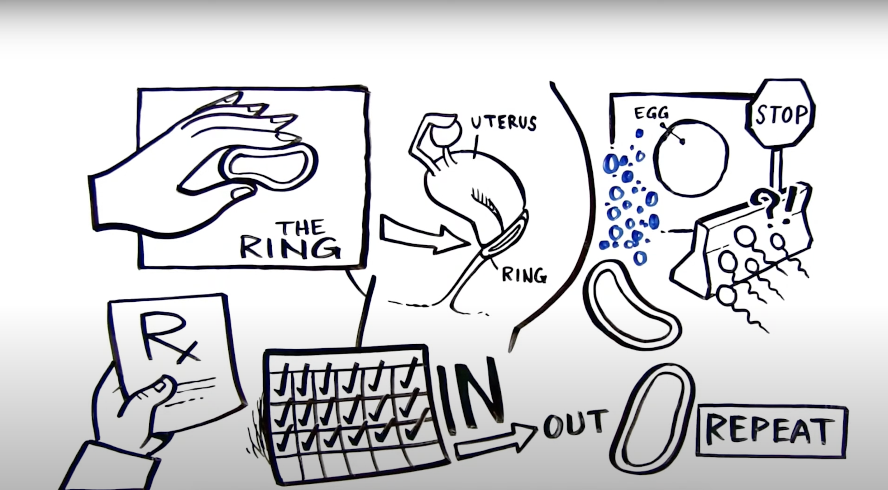 screenshot of an illustrated video that describes how the ring method of birth control works